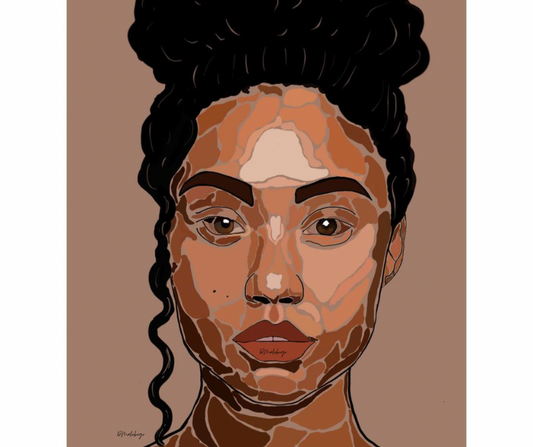 Skin of stories
